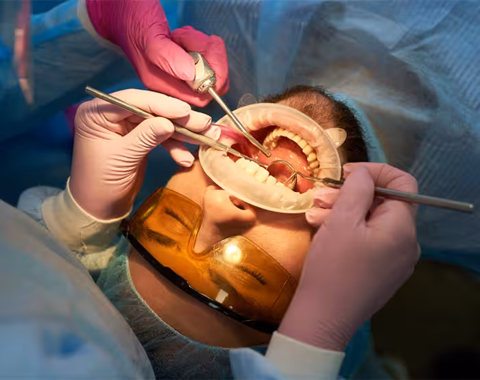 Wisdom tooth surgery